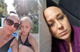 Po lewej zdrowa kobieta z córeczką, po prawej ta sama kobieta z objawami leczenia onkologicznego - brak włosów.